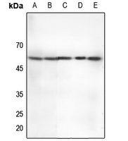 CHK2 (Phospho-T68) Rabbit Polyclonal Antibody