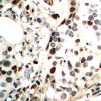 CHK2 (Phospho-T68) Rabbit Polyclonal Antibody