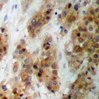 CMPK1 Rabbit Polyclonal Antibody