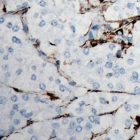 Collagen 18 alpha 1 Antibody
