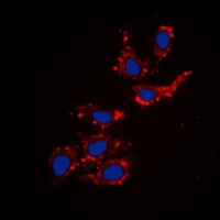 Collagen 18 alpha 1 Antibody