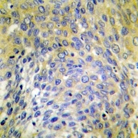 Collagen 4 alpha 6 Antibody