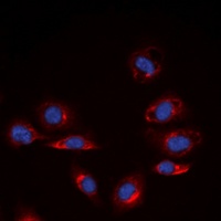 Collagen 4 alpha 6 Antibody