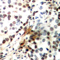 CREB (Phospho-S142) Rabbit Polyclonal Antibody