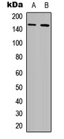 CD115 (Phospho-Y809) Rabbit Polyclonal Antibody