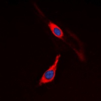CD115 Rabbit Polyclonal Antibody