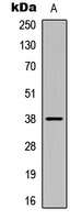 CK1 alpha (Phospho-Y294) Rabbit Polyclonal Antibody