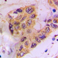 CK1 alpha (Phospho-Y294) Rabbit Polyclonal Antibody