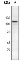 Catenin delta 1 (Phospho-Y228) Rabbit Polyclonal Antibody