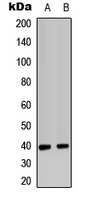 CD182 Rabbit Polyclonal Antibody