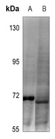 DDX5 (Phospho-Y593) Rabbit Polyclonal Antibody