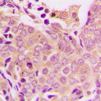 EIF4G1 Rabbit Polyclonal Antibody