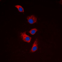 EIF4G1 Rabbit Polyclonal Antibody