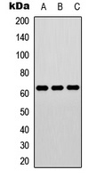 ELK1 (Phospho-T417) Rabbit Polyclonal Antibody