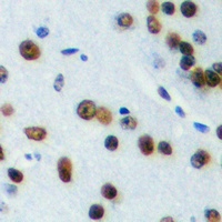 ELK1 (Phospho-T417) Rabbit Polyclonal Antibody