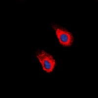 EPHA2 (Phospho-Y588/596) Rabbit Polyclonal Antibody