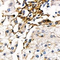 Fibrillin 1 Rabbit Polyclonal Antibody