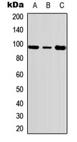 c-FER (Phospho-Y402) Rabbit Polyclonal Antibody