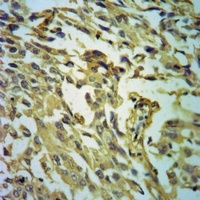 GDF9 Rabbit Polyclonal Antibody