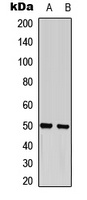 GFAP (Phospho-S38) Antibody