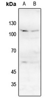 NMDAR1 (Phospho-S896) Rabbit Polyclonal Antibody