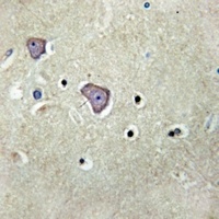 NMDAR1 (Phospho-S896) Rabbit Polyclonal Antibody