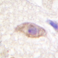 NMDAR2B (Phospho-Y1474) Rabbit Polyclonal Antibody