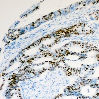 Histone H2A.Z (Acetyl-K5) Rabbit Polyclonal Antibody
