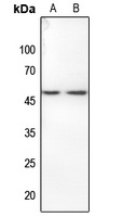 Histone Deacetylase 3 (Phospho-S424) Rabbit Polyclonal Antibody