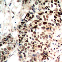Histone Deacetylase 3 (Phospho-S424) Rabbit Polyclonal Antibody