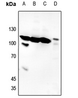 Histone Deacetylase 7 (Phospho-S155) Rabbit Polyclonal Antibody