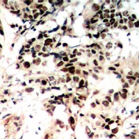 Histone H1 (Phospho-T17) Rabbit Polyclonal Antibody