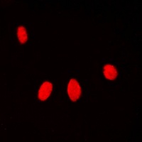 Histone H1 (Phospho-T17) Rabbit Polyclonal Antibody