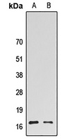HMGN2 Rabbit Polyclonal Antibody