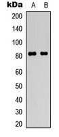 HSF1 (Phospho-S307) Rabbit Polyclonal Antibody