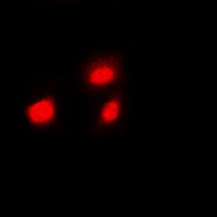 HSF1 (Phospho-S307) Rabbit Polyclonal Antibody