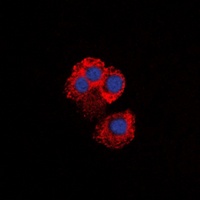 IKK gamma Rabbit Polyclonal Antibody