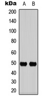 CD213a1 (Phospho-Y405) Rabbit Polyclonal Antibody