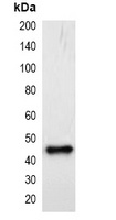 mCherry-tag Antibody