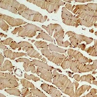 Beta3-tubulin Antibody