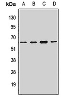 RAR alpha Rabbit Polyclonal Antibody