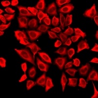 RAR alpha Rabbit Polyclonal Antibody