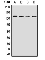 NUP98 Rabbit Polyclonal Antibody
