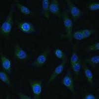 NUP98 Rabbit Polyclonal Antibody