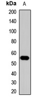 ACVR1C Rabbit Polyclonal Antibody