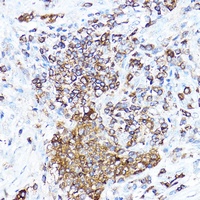 cIAP2 Antibody