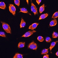 NMDAR2A Rabbit Polyclonal Antibody