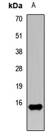 FABP5 Rabbit Polyclonal Antibody