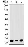 RAP1A Rabbit Polyclonal Antibody