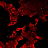 TLR7 Rabbit Polyclonal Antibody